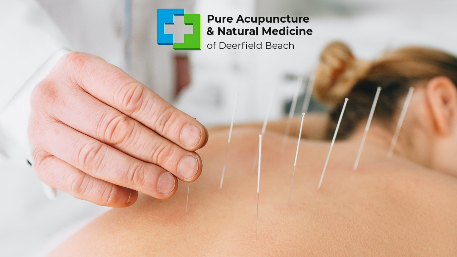 Finding Quality Acupuncture Near Me Pure Acupuncture